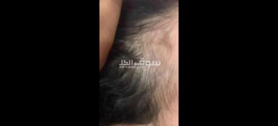 زيت تطويل الشعر وعلاج التقصف - 3
