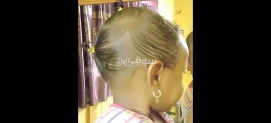 زيت تطويل الشعر وعلاج التقصف - 5