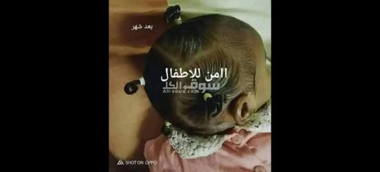 زيت تطويل الشعر وعلاج التقصف - 8